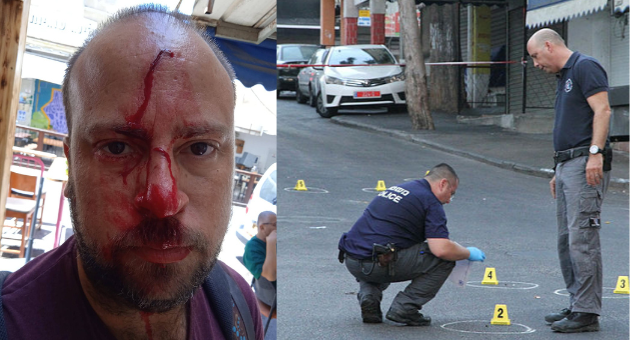 פעילות משטרה בשוק תלפיות ואייל לבקוביץ' אחרי תקיפתו